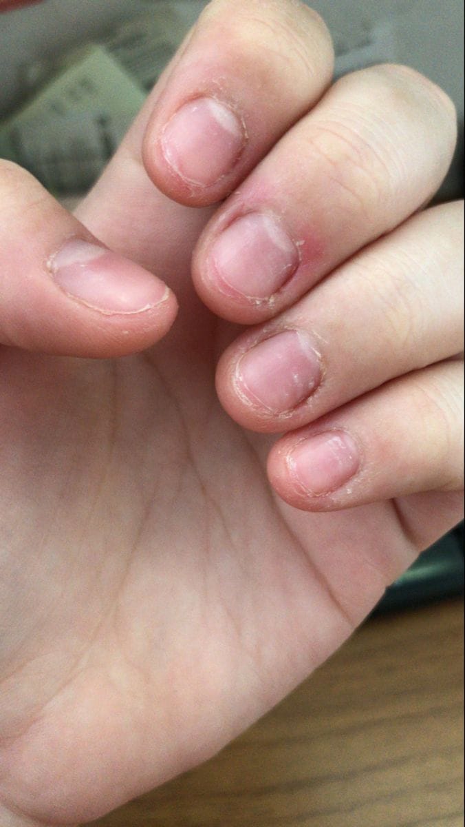 Antes - unhas naturais curtas